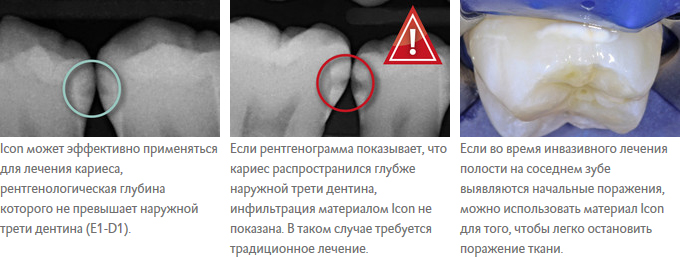 aprox_1.jpg