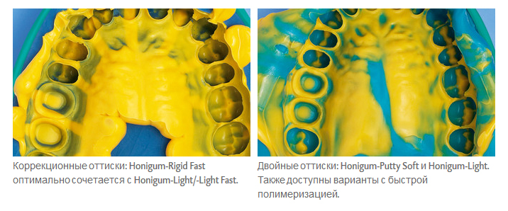 Honigum-Putty_ris.jpg