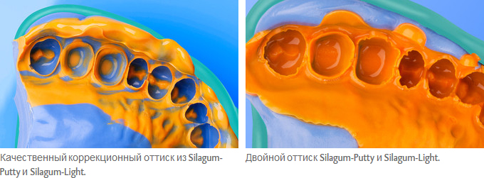 Silagum-Light_ris.jpg
