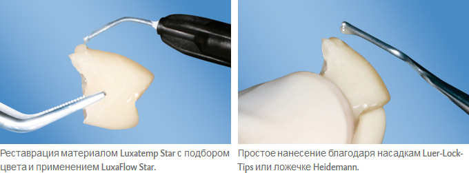 LuxaFlow_Star_ris.jpg