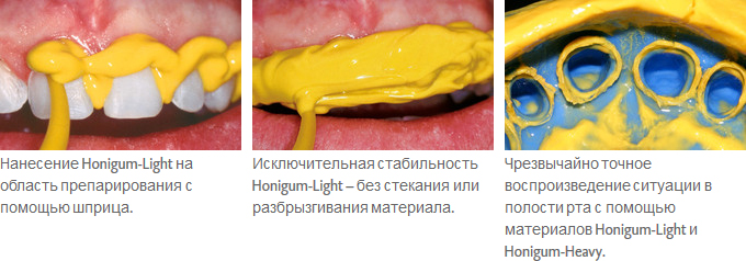 Honigum-Light_ris.jpg