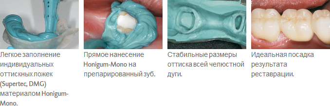 Honigum-Mono_ris1.jpg