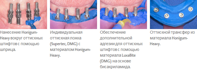 Honigum-Heavy_ris2.jpg