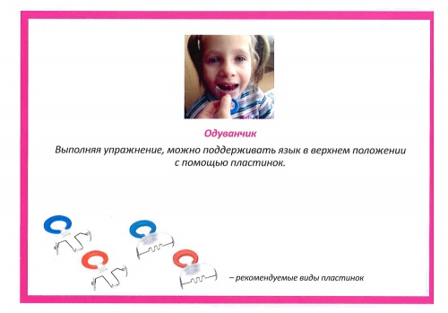 Артикуляционная гимнастика с использованием вестибулярных пластинок фото 5