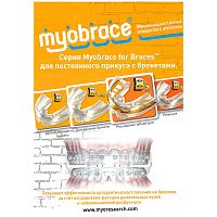 Каталог "Myobrace с брекетами"