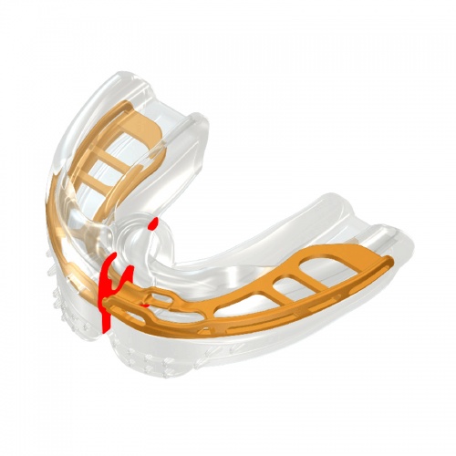Myobrace B2 фото 4