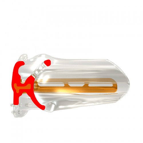 Myobrace B2 фото 3